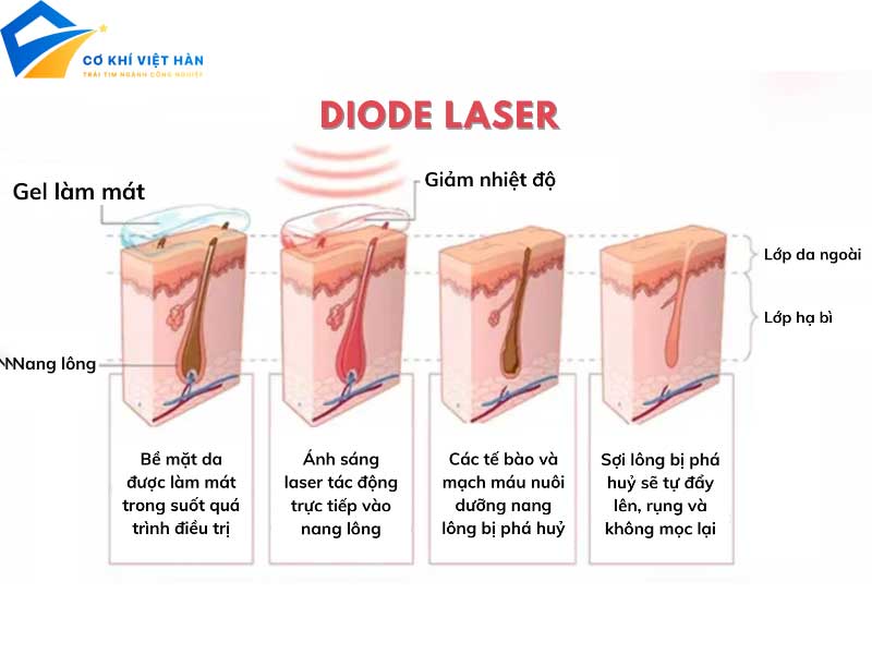 Laser Diode là gì